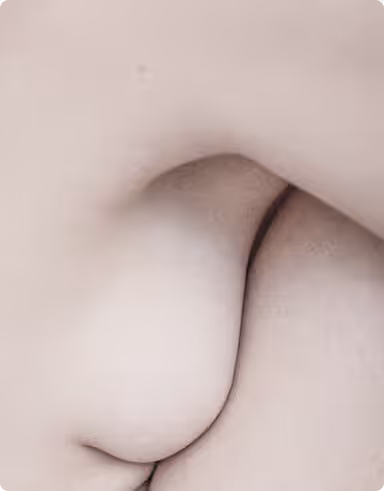 Chirurgia Rigenerativa del Seno