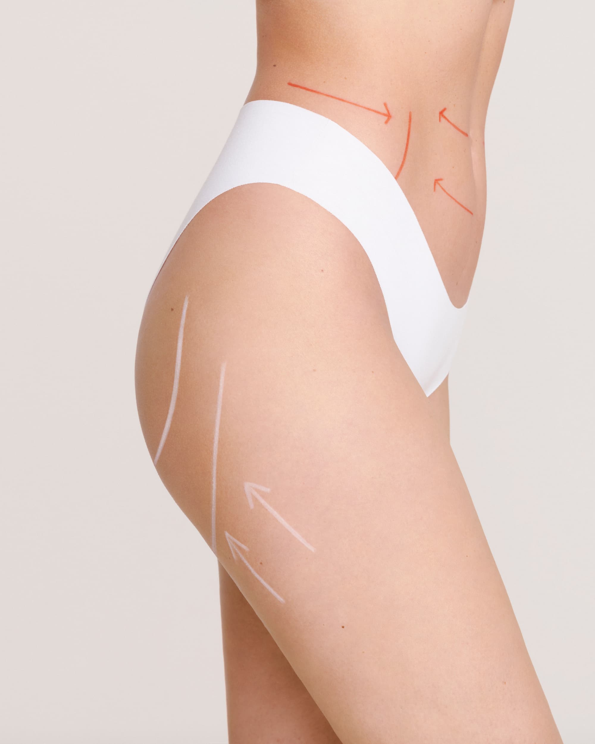 Liposuzione addome: come togliere il grasso dalla pancia?