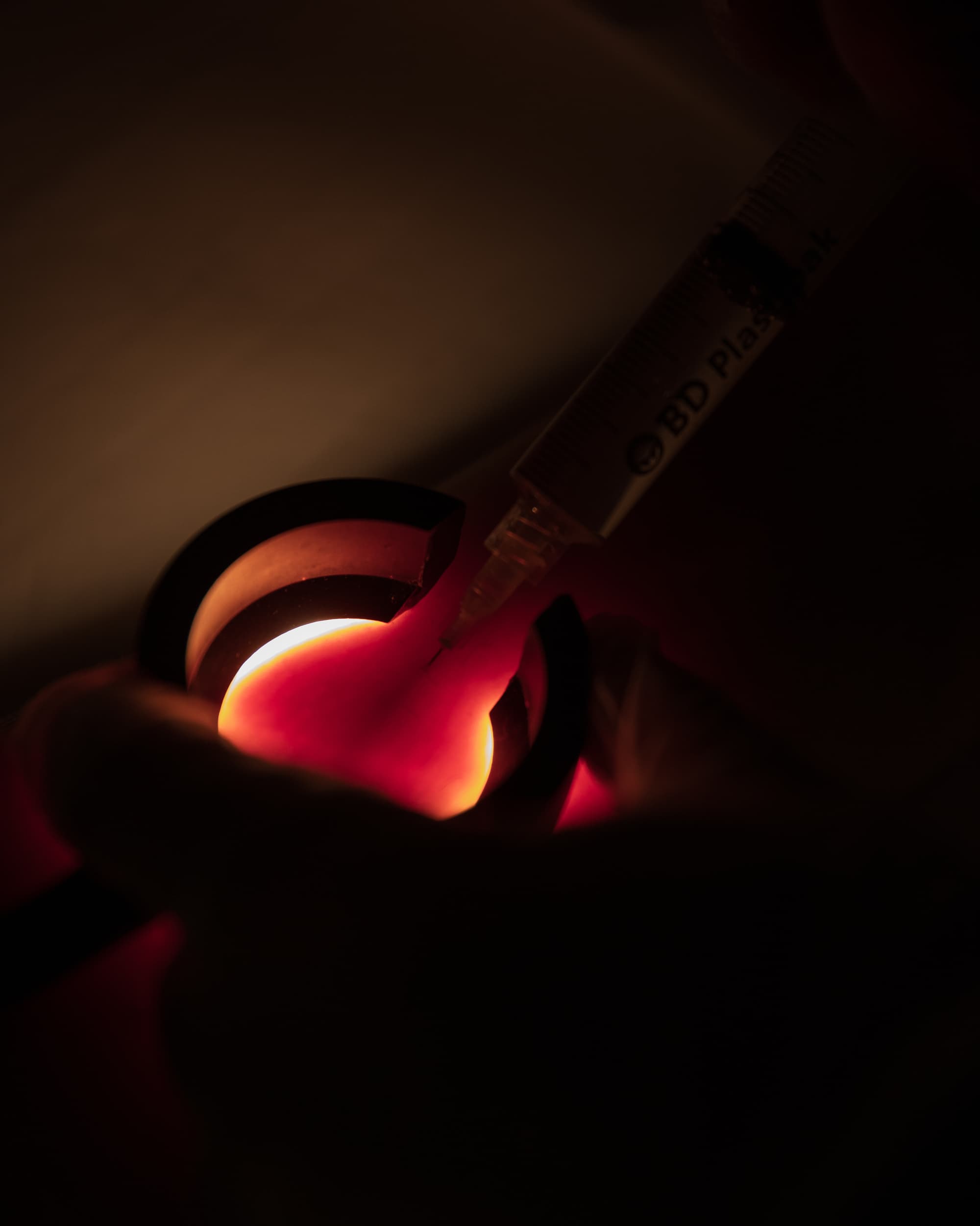 Che cos’è la Fleboterapia Rigenerativa Tridimensionale (TRAP)?