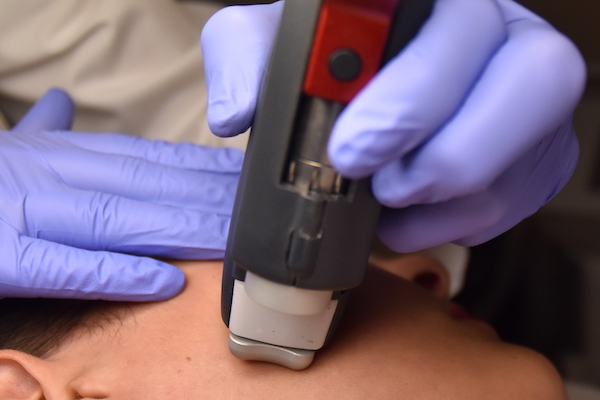 Autunno, tempo di Laser